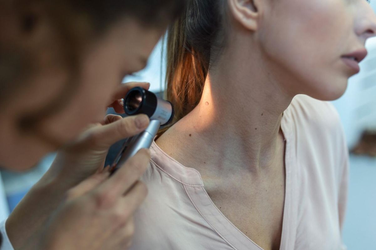 A fibróma jelensége: mit kell tudni róla?