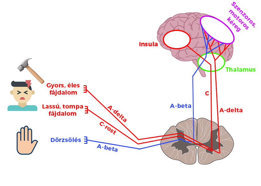 A fejfájás titkai: Miért fáj a fejünk, ha az agyban nincs fájdalomérző receptor?